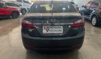 Hyundai HB20S completo